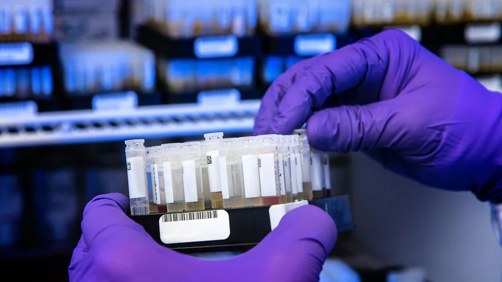 Hände mit Handschuhen halten mehrere beschriftete Probenröhrchen in einem medizinischen Labor. Im Hintergrund sind weitere Laborproben und Analysegeräte unscharf sichtbar.